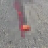 腸が飛び出てしまったお姉さん(閲覧注意!!)
