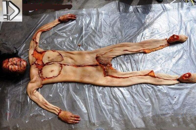 裸の女性の死体スライド（かなり閲覧注意！！）